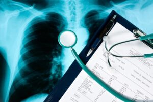 An X-ray image of a chest with a medical file and stethoscope placed on top, representing our guide on how to sue the NHS.