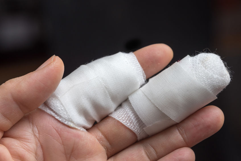 how-to-sue-your-employer-for-a-broken-finger-at-work-how-to-sue