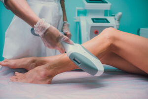 A practitioner conducting a laser hair removal procedure on a woman's leg.